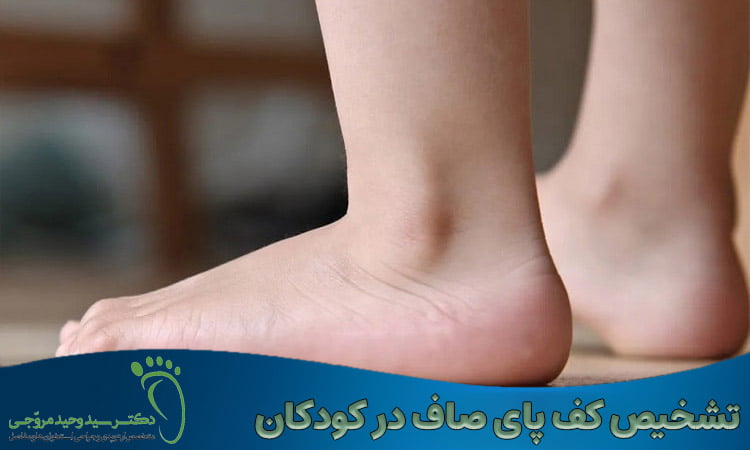 تشخیص صافی کف پا در کودکان