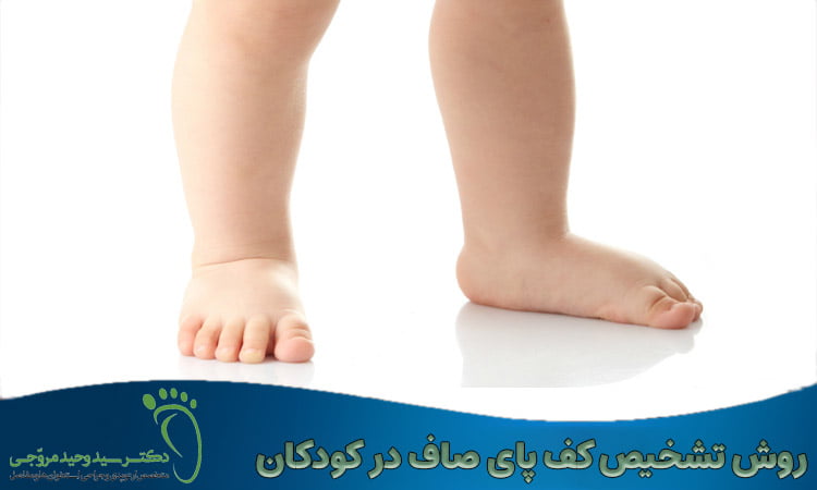 روش تشخیص کف پای صاف در کودکان