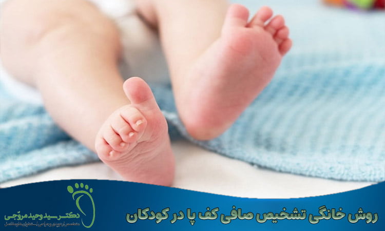 روش تشخیص صافی کف پا در کودکان