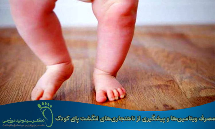 مصرف ویتامین‌ها برای پیشگیری ناهنجاری‌های انگشت پای کودک