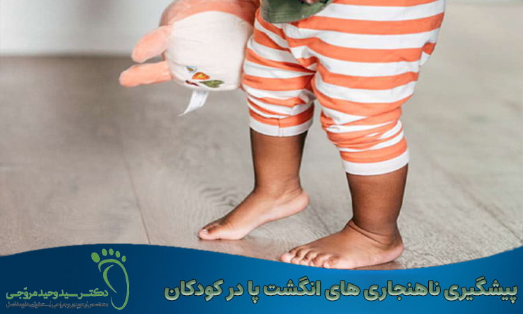 پیشگیری ناهنجاری های انگشت پا در کودکان