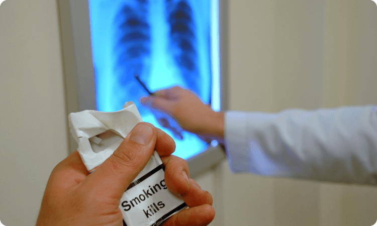 علل آسیب به استخوان‌ها در اثر مصرف سیگار