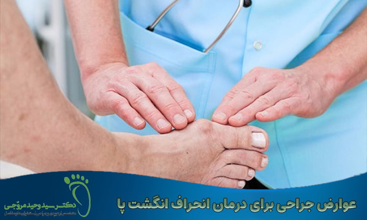 عوارض جراحی برای درمان انحراف انگشت پا