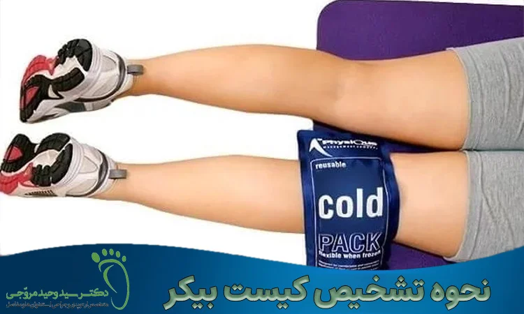نحوه تشخیص کیست بیکر