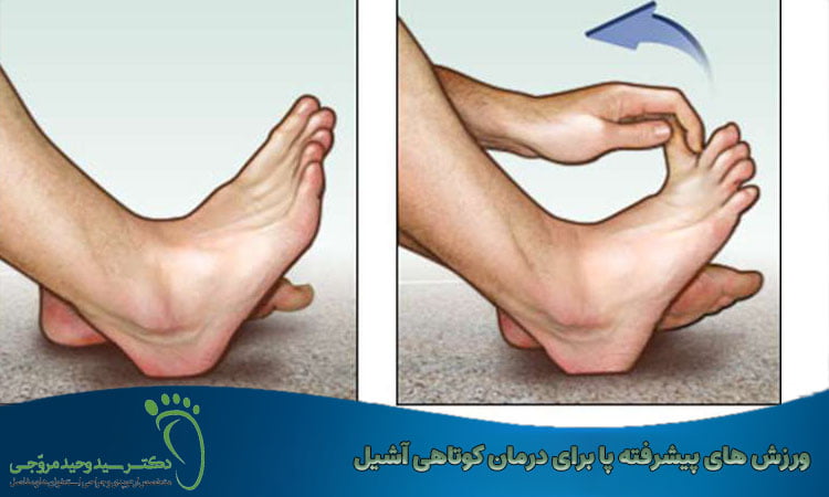 ورزش های پیشرفته پا برای درمان کوتاهی آشیل
